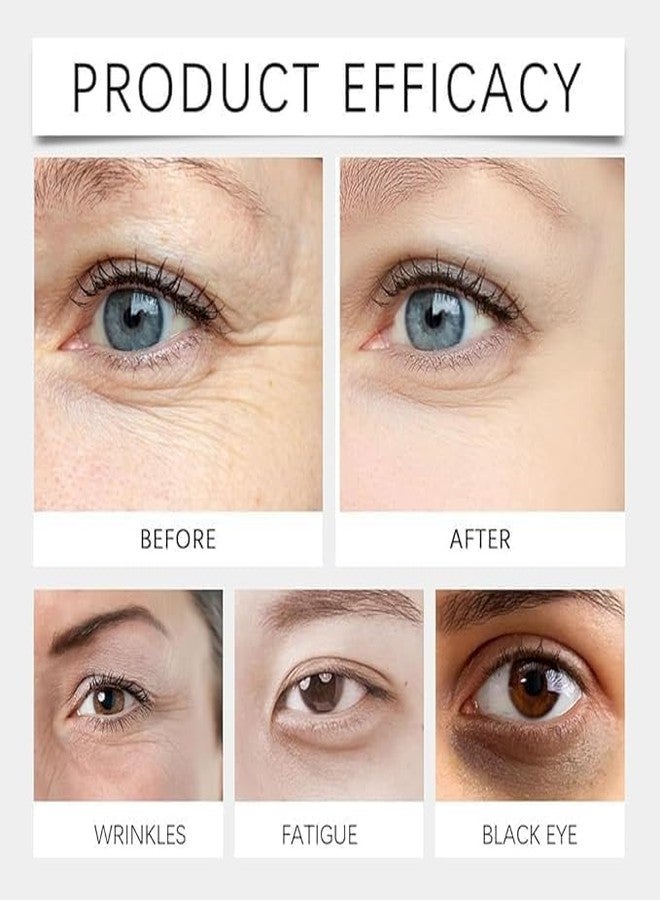 Lutein & VC Eye Serum - Anti-Aging Eye Essence Oil for Wrinkles, Dark Circles, Puffiness, and Eye Bags - Firming & Brightening - Image 2