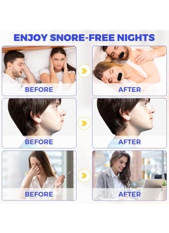 VOGSIG 30 Patches Good Night Tape Mouth Tape Sleep Strips Soft and Comfortable Gentle and Secure Adhesive Sleep Mouth Tape Anti Snoring Less Mouth Breathing Odour Free Sleep Strips Mouth Tape  - Image 2