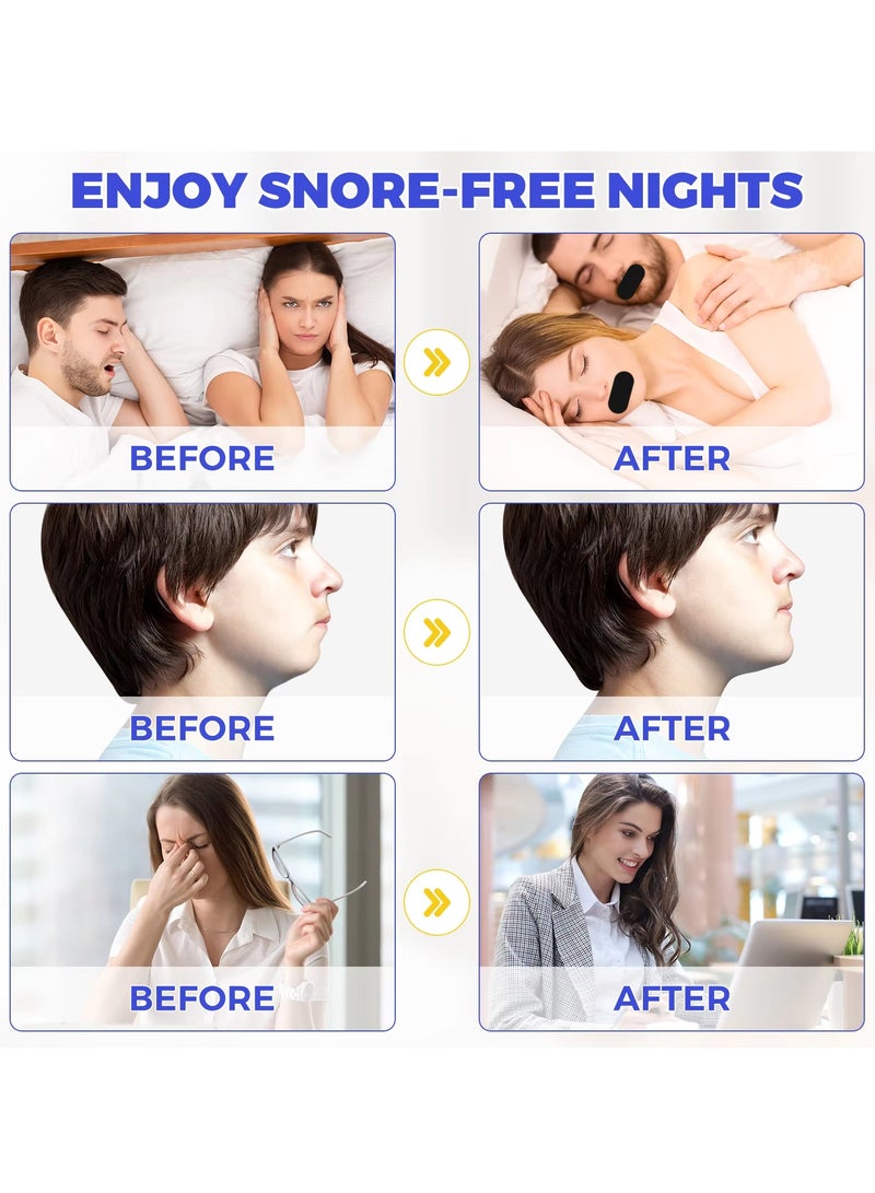 VOGSIG 30 Patches Good Night Tape Mouth Tape Sleep Strips Soft and Comfortable Gentle and Secure Adhesive Sleep Mouth Tape Anti Snoring Less Mouth Breathing Odour Free Sleep Strips Mouth Tape - Image 2