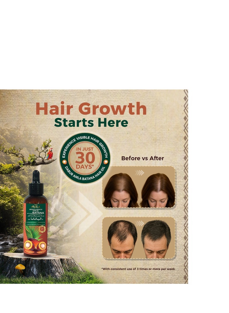 دابر Dabur Amla Pure Batana Growth Hair Oil - 95 مل | مع باتانا خام 100٪ وفيتامين E | يعزز نمو الشعر ويمنع تساقط الشعر وترققه ويحسن النعومة ويعزز اللمعان | من مصادر أخلاقية من هندوراس | مناسب لكل من النساء والرجال - Image 3