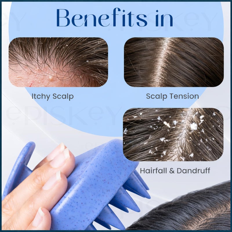 Episkey Scalp Massager Shampoo Brush, Eco-Friendly Wheat Straw Body With Soft Silicon Bristles, Hair Scalp Scrubber, Scalp Exfoliator | Dandruff Removal, Prevents Hair Loss For Men, Women (Jb-35) - Image 3