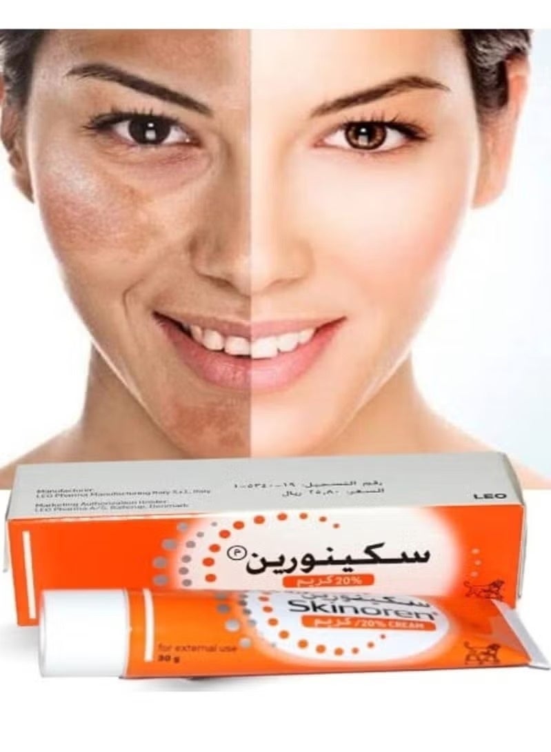 Skinoren Anti Acne Treatment Cream 30g - Image 3
