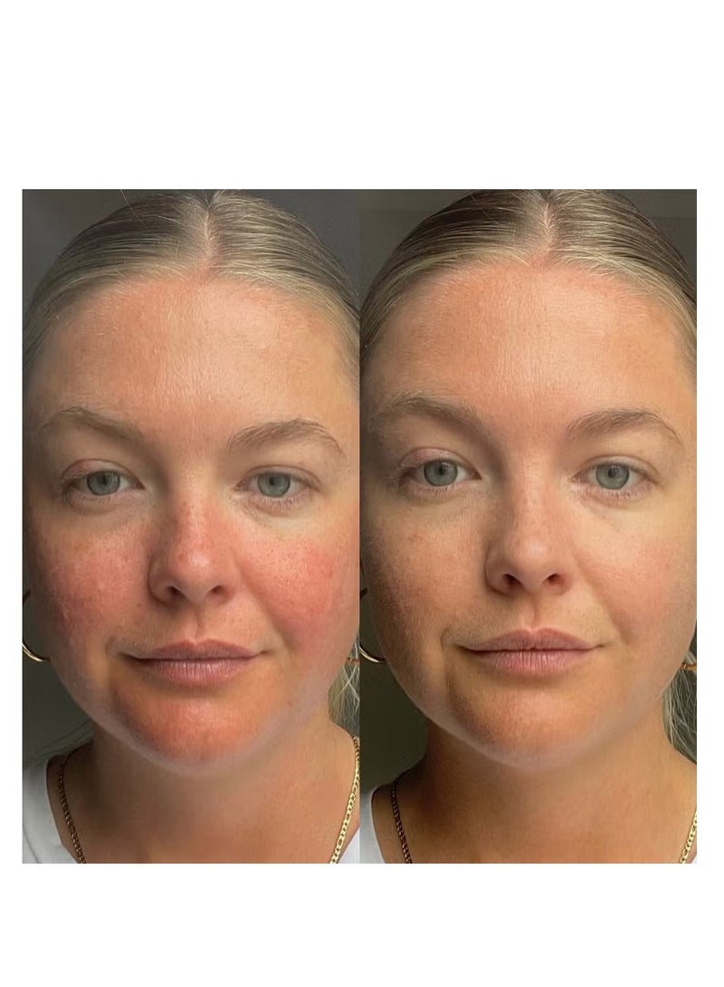 دي آر. جارت+ قطرات دكتور جارت+ سيكابير بخلاصة عشبة النمر المموهة بعامل حماية من الشمس 35، 30 مل - Image 3