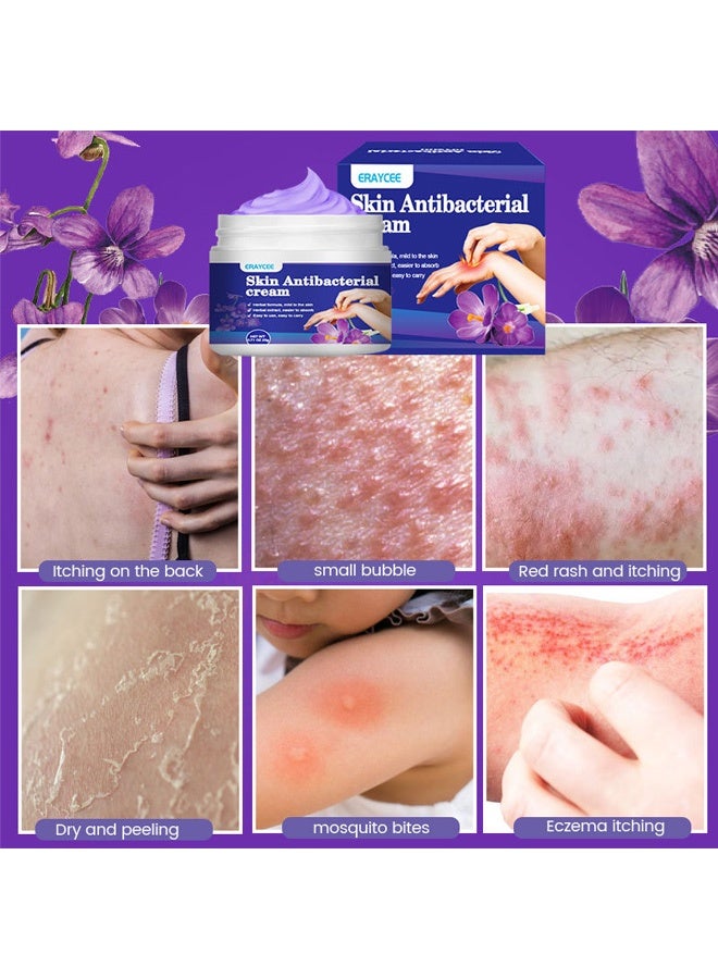 ERAYCEE Skin Antibacterial Anti Itch Cream, Bug Bite Itch Relief, Soothes Sunburns, Rashes, and Minor Skin Irritation - Image 4