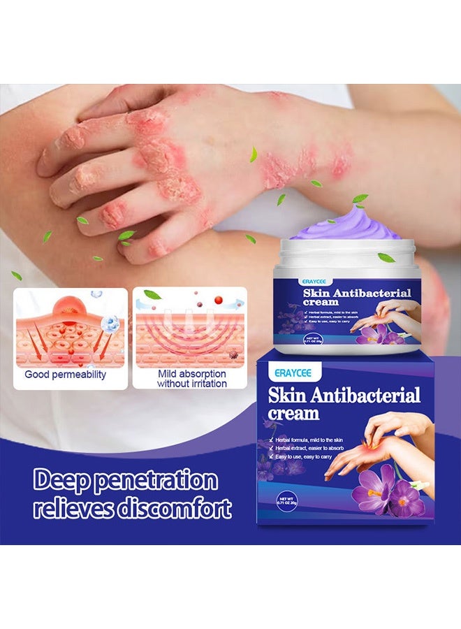 ERAYCEE Skin Antibacterial Anti Itch Cream, Bug Bite Itch Relief, Soothes Sunburns, Rashes, and Minor Skin Irritation - Image 3