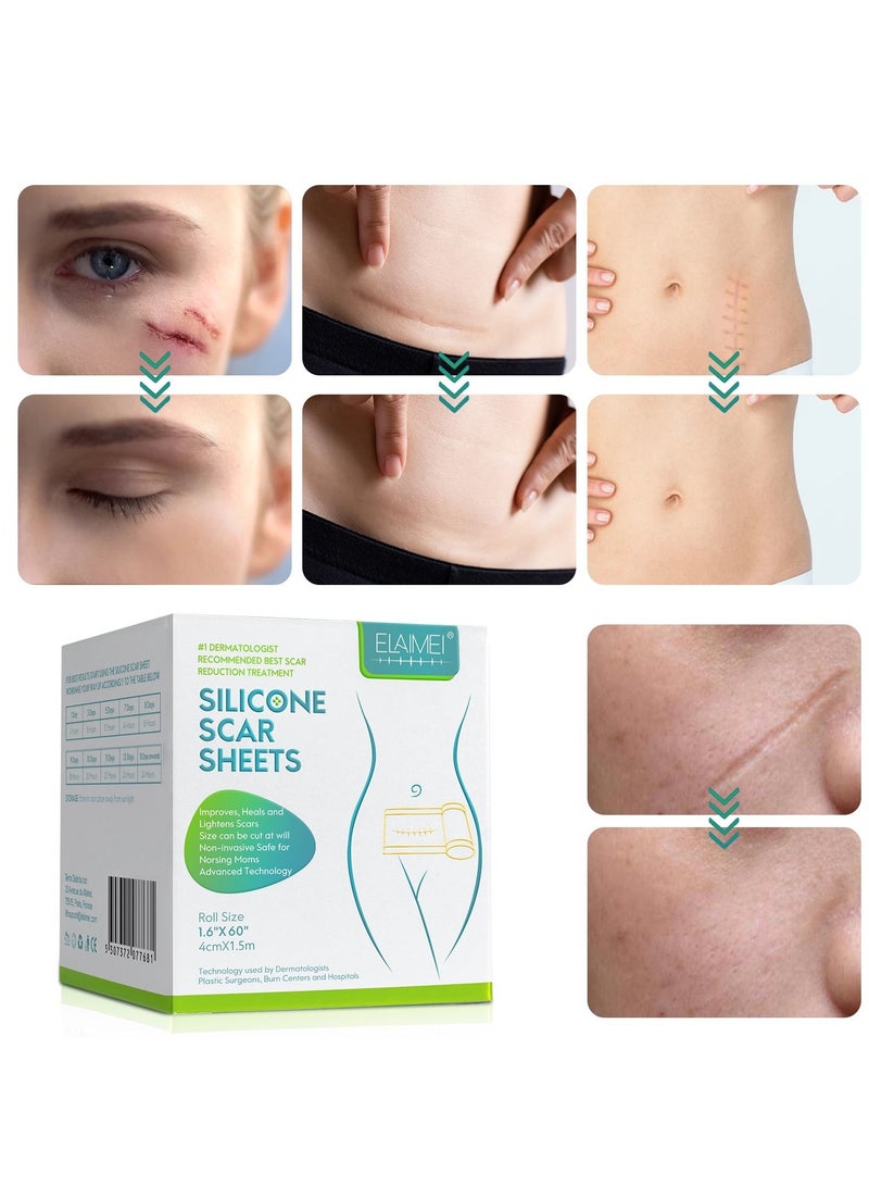 إليمي شريط السيليكون لعلاج ندبات الجروح والحروق, لصقة إزالة الندبات من السيليكون الطبي, علاج الندبات الناتجة عن الجراحة التجميلية و حروق الوجه والجسم - Image 3