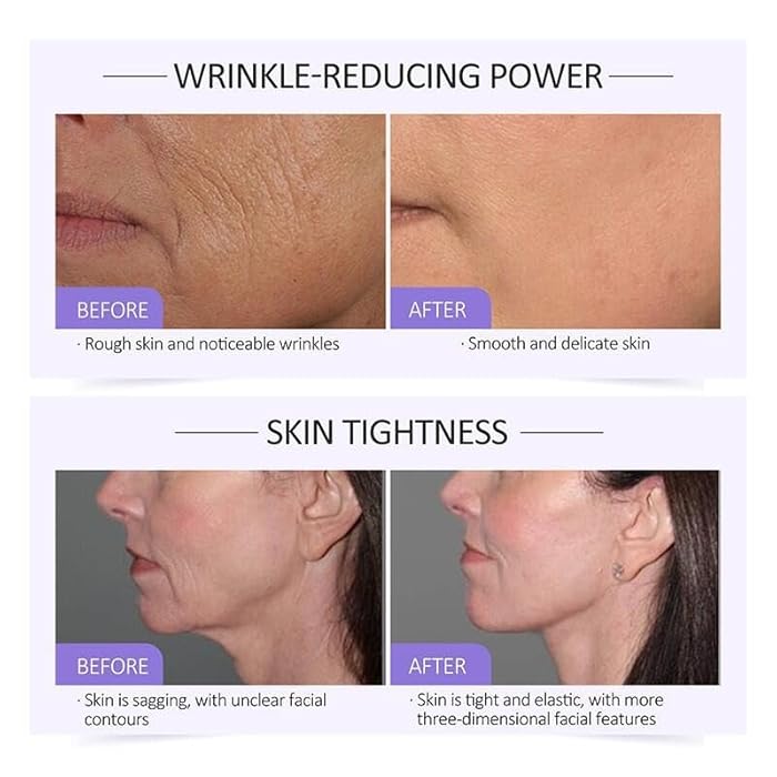 Grospe Collagen Serum For Face, Collagen Face Serum For Skin Tightening Helps Lift, Plump, & Firm Sagging Skin, Serums For Skin Care, Anti Wrinkle 1.35 Fl Oz - Image 4