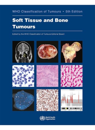 Soft Tissue and Bone Tumours: Who Classification of Tumours - pzsku/ZF02A60A4618BEEF30E47Z/45/_/1744120847/758e8bf4-2a13-423f-954b-1fa31af46bc1