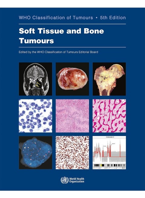 Soft Tissue and Bone Tumours: Who Classification of Tumours
