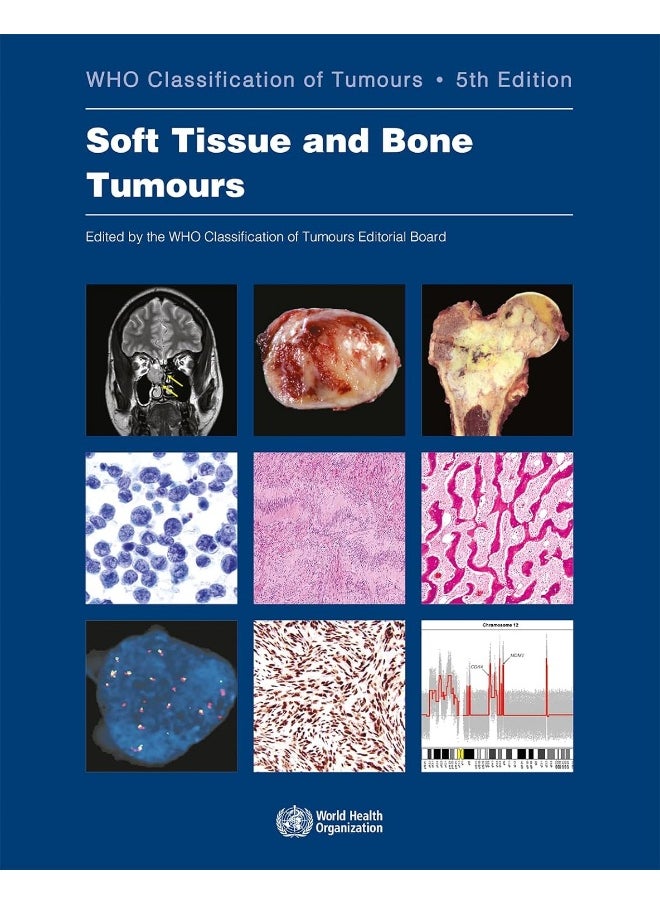 Soft Tissue and Bone Tumours: Who Classification of Tumours