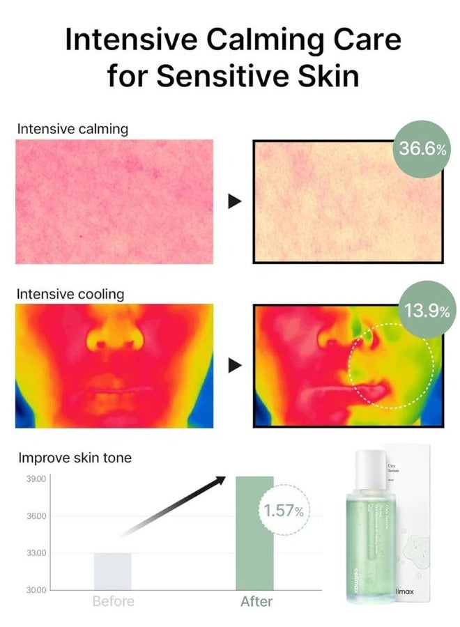 celimax سيروم ذا ريل سيكا نياكيناميد AC المهدئ 40 مل، مع حمض الهيالورونيك، تخفيف الاحمرار، مرطب، مهدئ واستعادة السيروم - Image 5