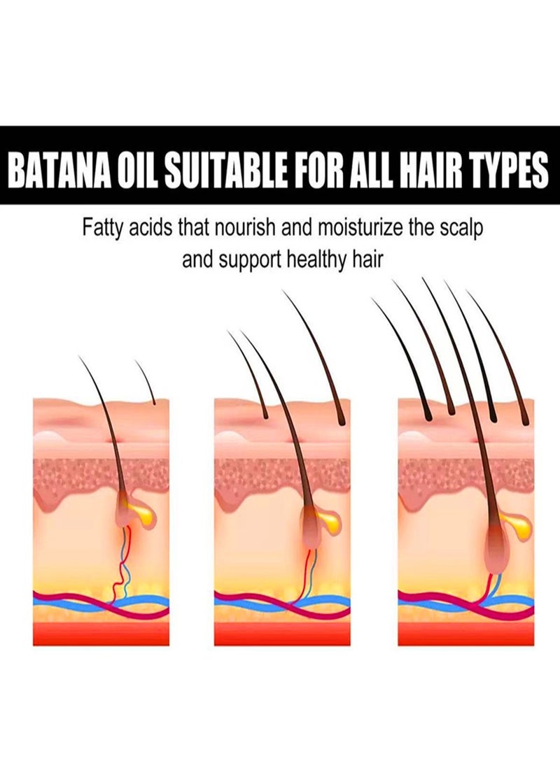 إيلهو الزيت لنمو الشعر باتانا زيت باتانا الزيت العضوي لإصلاح الشعر الصحي الشعر التالف يتغذى على شعر رفيع الشعر - Image 2
