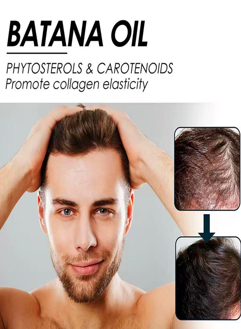 إيلهو الزيت لنمو الشعر باتانا زيت باتانا الزيت العضوي لإصلاح الشعر الصحي الشعر التالف يتغذى على شعر رفيع الشعر - Image 3