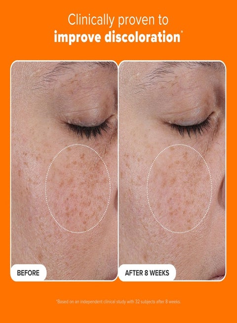 PAULA'S CHOICE Paula's Choice 25% Vitamin C Serum with Glutathione &  Antioxidants, Face Serum Improves Discoloration, Uneven Tone & Firms, All  Skin Types, Fragrance-Free, 1oz | Best Price Oman