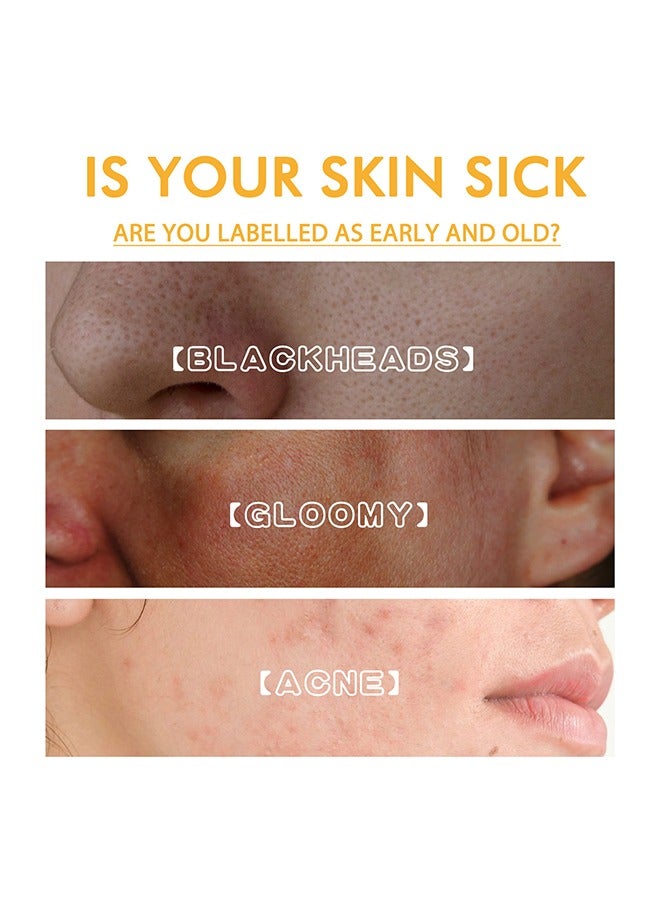 EELHOE Honey Muscle Tearing Mask-Oil Control Blackhead Remover Honey Tearing Peel Mask Off Dead Skin Clean Pores ,Skin Brightening Peeling Mask for Dull Skin-100g - Image 4