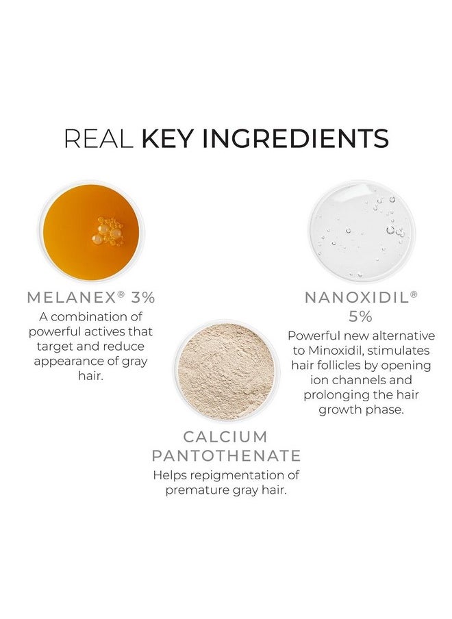 DS LABORATORIES - Spectral.Dncs Hair Serum Hair Serum For Hair Growth Support And Antigray Hair Serum Zinc 5% Nanoxidil Niacinamide Rosemary & Biotin Hair Growth Serum Thickening Hair Products - Image 1