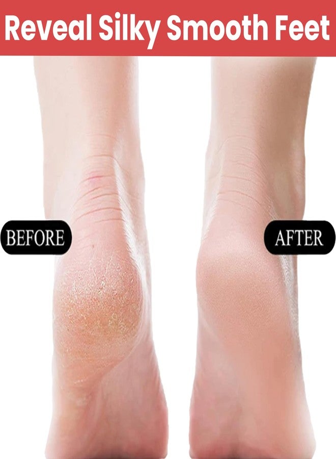 TEMPERIA (1pc) 4 In 1 Double Sided Foot File Scrubber - Dead Skin & Callus Remover - Feet Scraper - Pedicure Tool - (Foot Scrubber, Black Emery Foot Filer, Pumice Stone, Foot Brush) (HF113) - Image 3