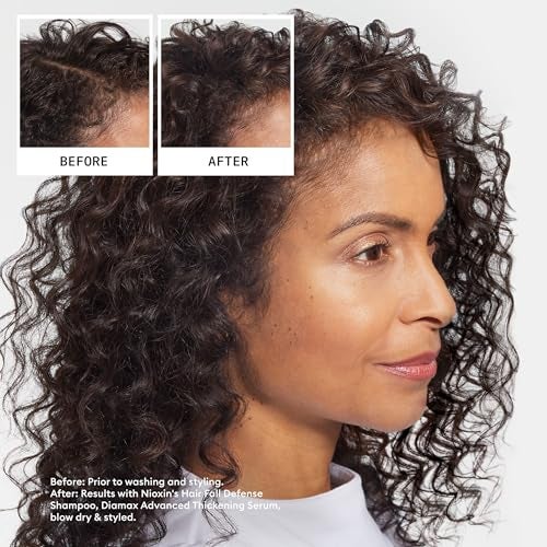 NIOXIN Hair Fall Defense Shampoo | Activates Hair Follicles for Visibly Less Hair Loss | With Niacinamide, Caffeine, Lauric Acid, and Sandalore | 8.1 Fl Oz. - Image 4