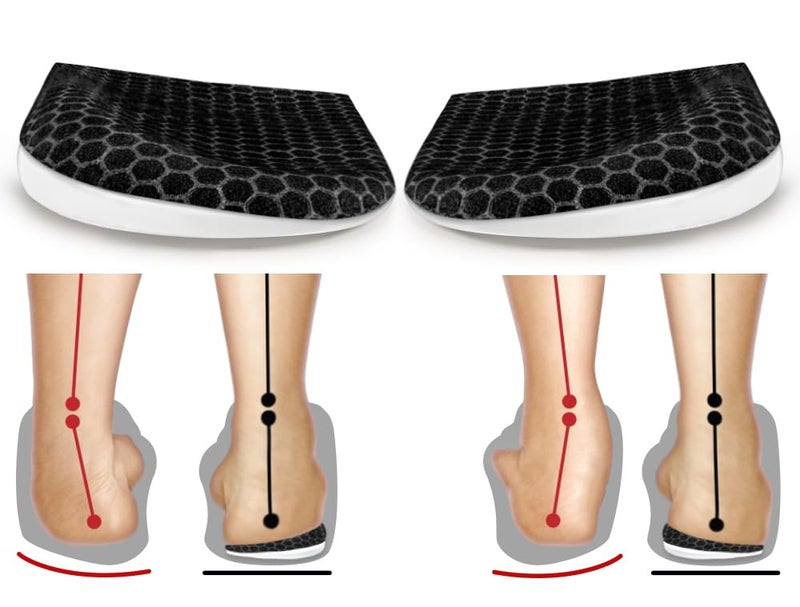 BIGGCOOL BIGGCOOL Corrective Insoles for Supination OverPronation Orthotics Medial Lateral Heel Wedge Inserts for Foot Alignment Bow Legs Knee Pain Black2 Layers L Women 812Men 7513