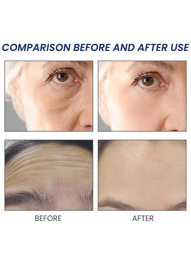 OUHOE Instantly Botox Stock Solution - Facial Serum for Face Tightening Botox Reduce Fine Lines Wrinkles Boost Skin Collagen Hydrate and Plump Skin Face Serum Botox Stock Anti Aging Serum 30ml - Image 5