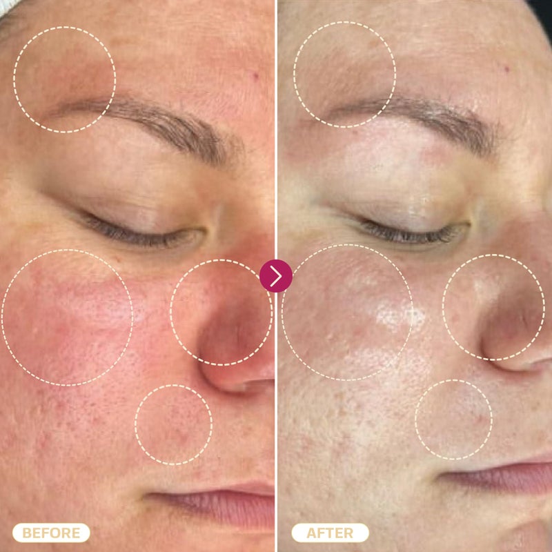 BASE LABORATORIES Hypochlorous Acid Spray for Face & Skin | 8 oz | Facial Daily Skin Repair Solution for Sensitive Skin, Redness, Irritations, Eczema, Acne. Hypochlrous HOCL Molecule Spray - Image 5