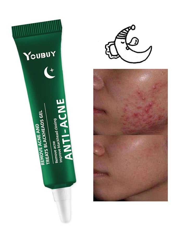 YOUBUY Anti - Acne Cream,Remove Acne and Treats Blackheads Gel ,Remove Acne Pimple and Treats Blackhead with Azelaic Acid Oil, Control Shrink Pores Redness ,Acne Remover Cream,Night Use 20g - Image 1