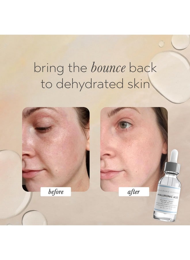 Hyaluronic Acid Face Serum, 1 Oz - Deep Hydration And Repair Dryness To Skin Promoting Natural Skin Glow