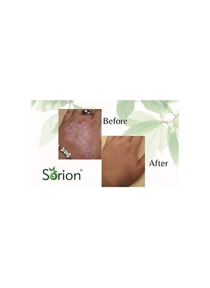 Sorion - Cream With Neem And Turmeric For Dry Itchy & Flaky Skin 50g - Image 1