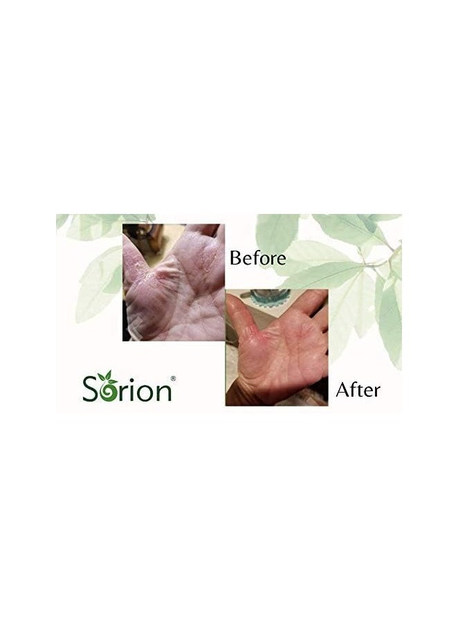 Sorion - Cream With Neem And Turmeric For Dry Itchy & Flaky Skin 50g - Image 1