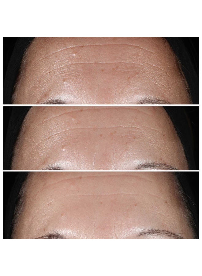 CLINIQUE Smart Clinical Repair Wrinkle Correcting Serum - Image 3