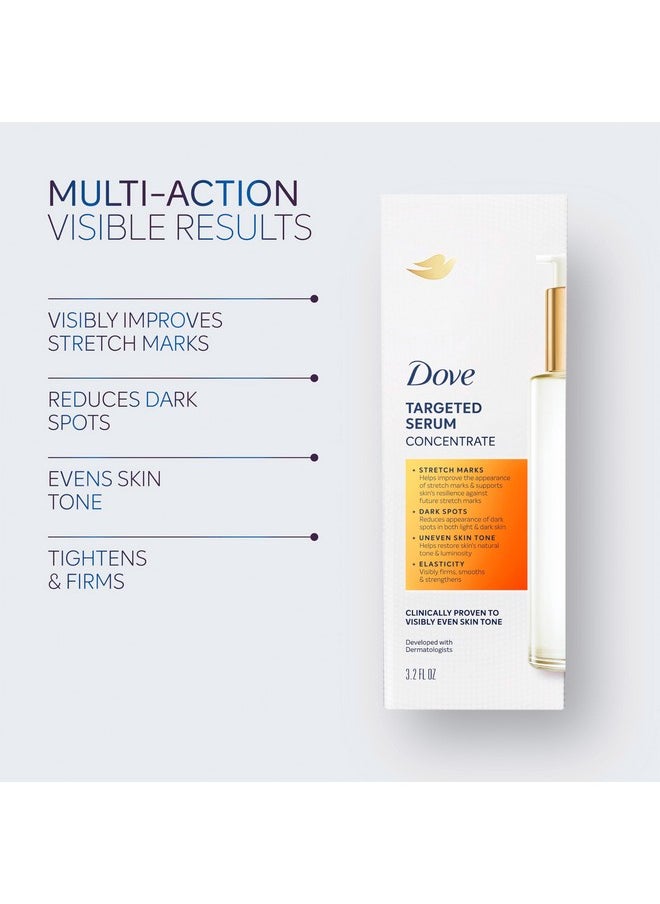 Dove - Dove Targeted Serum Multipurpose for Stretch Marks, Dark Spots, Uneven Skin Tone and Elasticity,with Tone Balance Complex, Niacinamide, Collagen Peptides and Natural Moisturizing Factors, 3.2 oz - Image 1