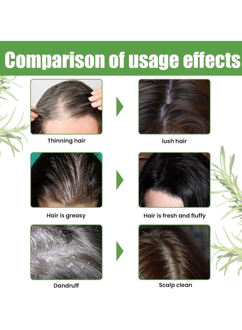 EELHOE Rosemary shampoo, rosemary water for hair, rosemary oil hair shampoo for women, hair growth shampoo against hair loss, biotin shampoo gently cleans the scalp sewing and moisturises the hair - Image 4