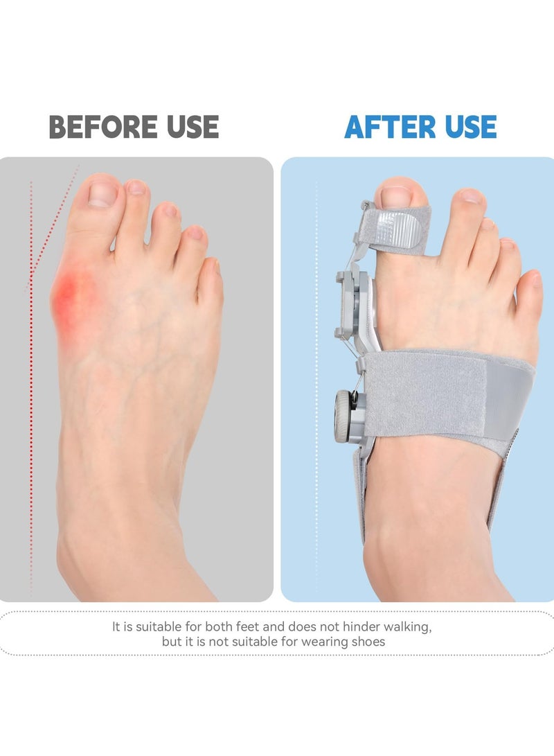 Arabest Adjustable Orthopedic Toe Straightener, Comfort Bunion Corrector for Women & Men, Rotated According to the Degree Of Bunion, Day Night Support Big Toe Separator for Bunion Relief, Right Feet - Image 2