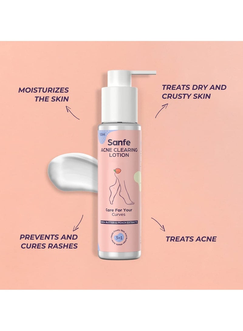 Sanfe Acne Clearing Lotion Ingrowns Dry Crusty Skin 10X Power Shea Butter Exfoliation Lightening 24Hr Moisture 100ml - Image 2