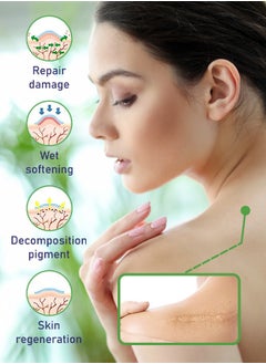 NIKITA.VIVI Silicone Scar Sheets 1.5M Beige Effective Scars Away Silicone Scar Sheets for Surgical Scars C Section Burn Scar Removal Gel Medical Grade Gel Scar Tape Silicone Scar Plaster  - Image 2