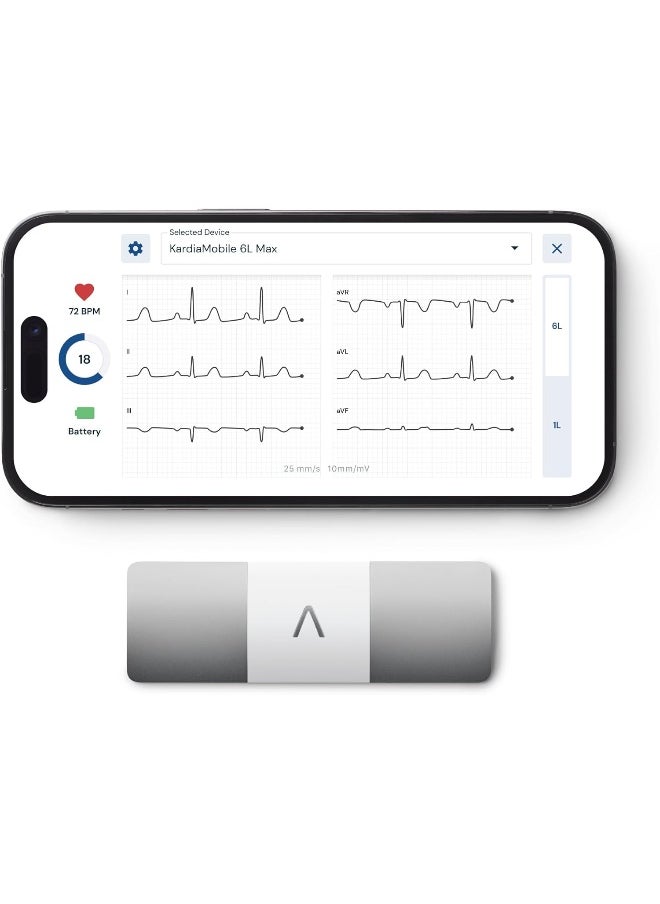 AliveCor KardiaMobile Personal EKG Heart Rate Monitor – 6 Leads - Record EKGs at Home - Detect Irregular Heartbeats and Irregular Arrhythmias - Includes 1 Year Access - Works with Most Smartphones