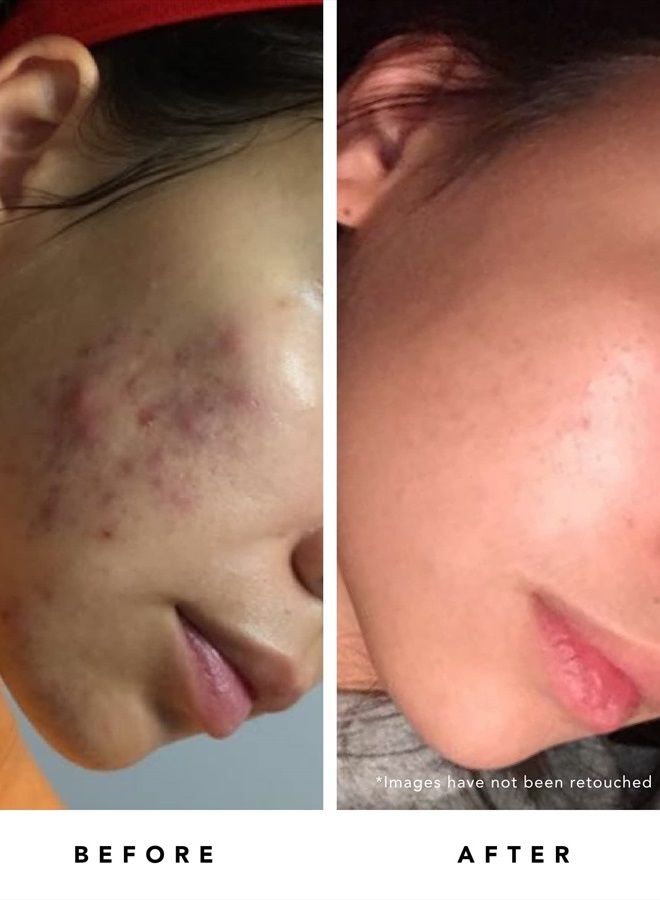 HERBIVORE Botanicals Blue Tansy BHA and Enzyme Pore Refining Mask. Gently Clarify Skin, Minimize Pores and Soothe Redness (2.02 oz) - Image 3