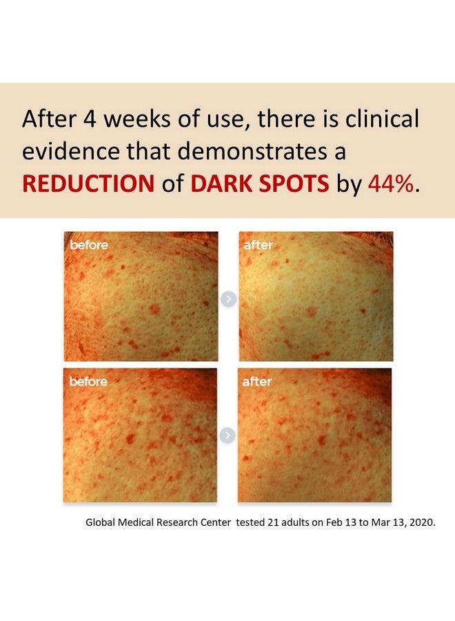 MAKEP:REM [Make p:rem] Poncirus trifoliata C Dark spot serum | Skin clearing serum | Uneven Skin Tone Treatment | Vitamin serum C face | 40ml, 1.35 fl.oz. | Make P:REM - Image 3