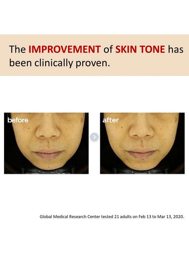 MAKEP:REM [Make p:rem] Poncirus trifoliata C Dark spot serum | Skin clearing serum | Uneven Skin Tone Treatment | Vitamin serum C face | 40ml, 1.35 fl.oz. | Make P:REM - Image 4