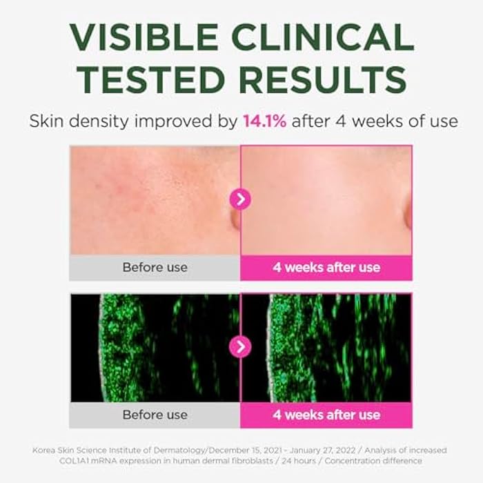 CKD Guaranteed CKD Retino Collagen Pumping Ampoule – Firming & Pore-Refining Facial Serum for Skin Elasticity. Enhances Collagen, Improves Skin Texture & Tone, Strengthens Skin Barrier, Korean Skincare, 1.01 fl oz - Image 3