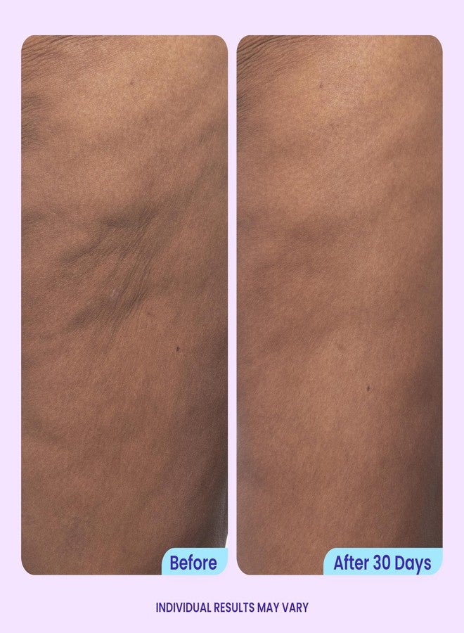 goPure Firming Butt & Thigh Cream - Skin Tightening Cream for Body with 8% MaxLift3 Complex - Visibly Smooths Stretch Marks - Cellulite Cream & Crepe Solution - Hydrating Barrier - Clinically Tested - Image 2