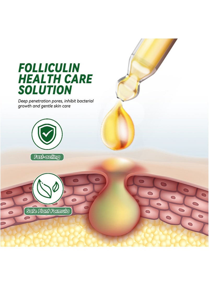 سوميفون محلول فوليكولين للرعاية الصحية، لتخفيف حكة بصيلات الشعر، ومسام الاختراق العميقة، ومنع نمو البكتيريا والعناية اللطيفة بالبشرة، ومناسب للأكزيما وبصيلات الشعر والحطاطات والبثور وحكة الجلد (30 مل) - Image 4