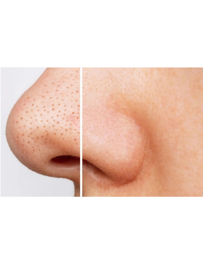 Ce-tua Nose Pore Strips Apple Flavor - 3 Strips  - Image 2