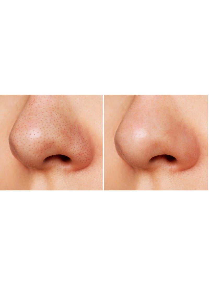 Ce-tua Nose Pore Strips Apple Flavor - 3 Strips  - Image 3