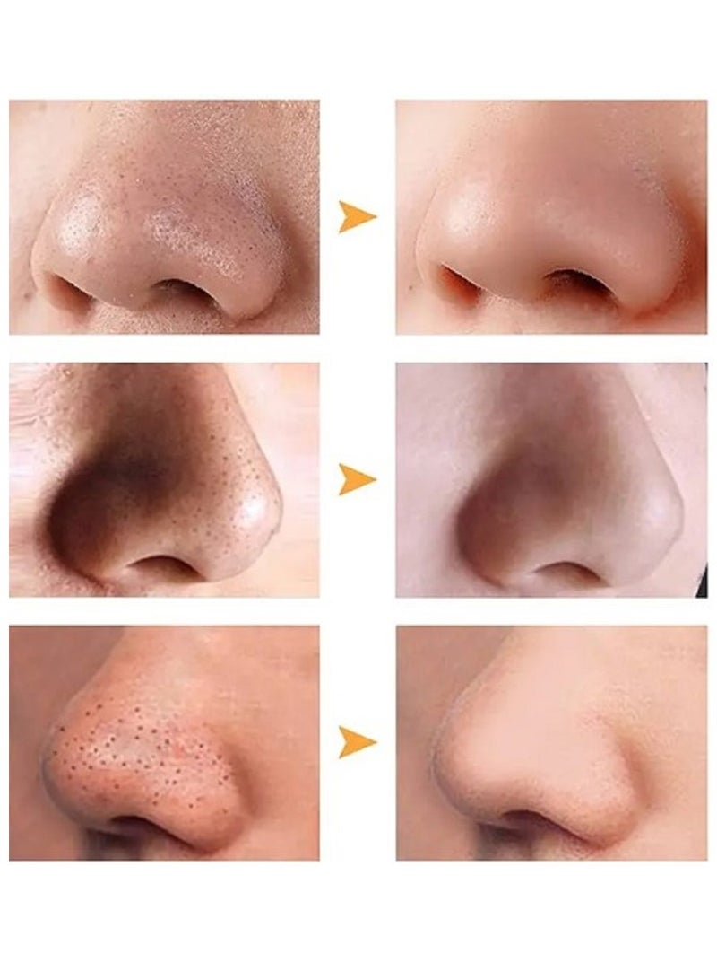 Ce-tua Nose Pore Strips Apple Flavor - 3 Strips  - Image 4