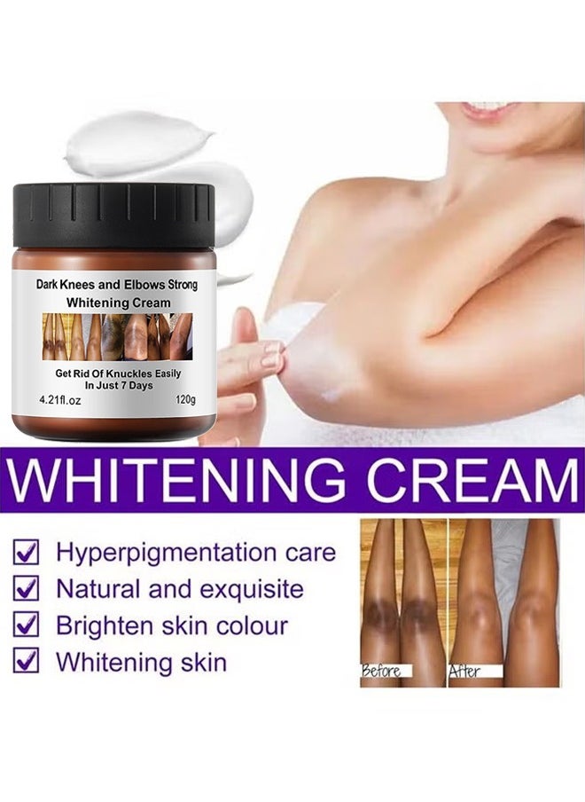 MOOYAM - Dark Knees And Elbows Strong Whitening Cream, Get Rid Of Knuckles Easily In Just 7 Days, Practical Bleaching Body Lotion For Armpits, Neck, Knee, Elbow, Inner Thigh, Intimate Area, 120G - Image 1