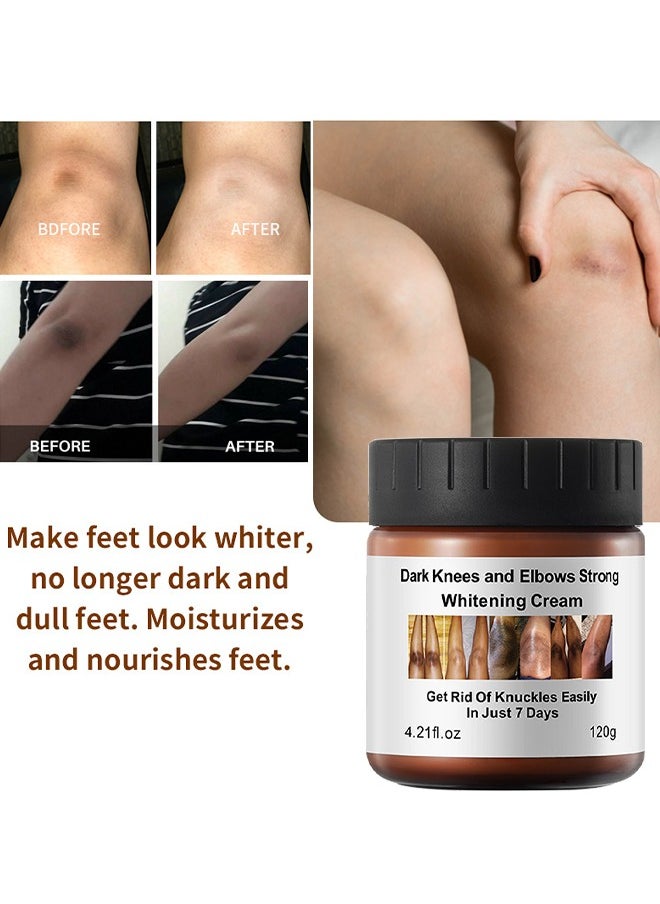 MOOYAM - Dark Knees And Elbows Strong Whitening Cream, Get Rid Of Knuckles Easily In Just 7 Days, Practical Bleaching Body Lotion For Armpits, Neck, Knee, Elbow, Inner Thigh, Intimate Area, 120G - Image 1