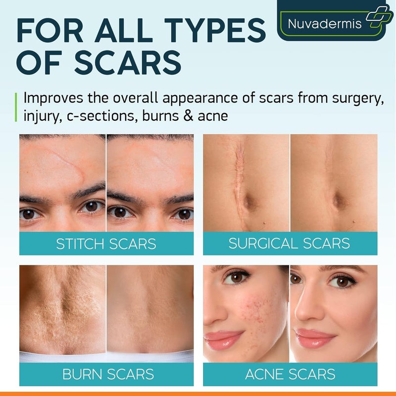 Nuvadermis مجموعة العناية بالندبات من نوفاديرميس: جل متقدم للندبات وشريط سيليكون للندبات - Image 5