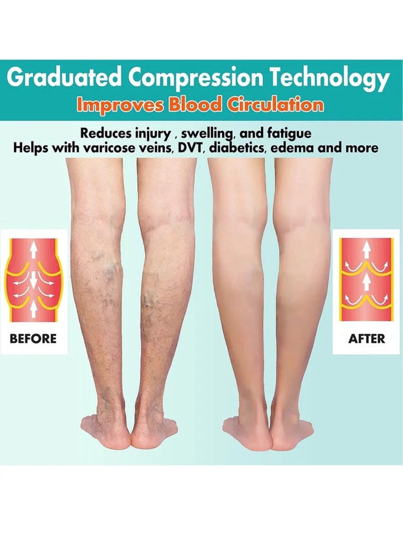 2 Pairs Compression Socks Open Toe Compression Stockings Knee High Socks with Zipper Compression Pantyhose 15-20mmHg for Improves Blood Circulation Prevents Leg Swelling (Beige Black) - Image 3