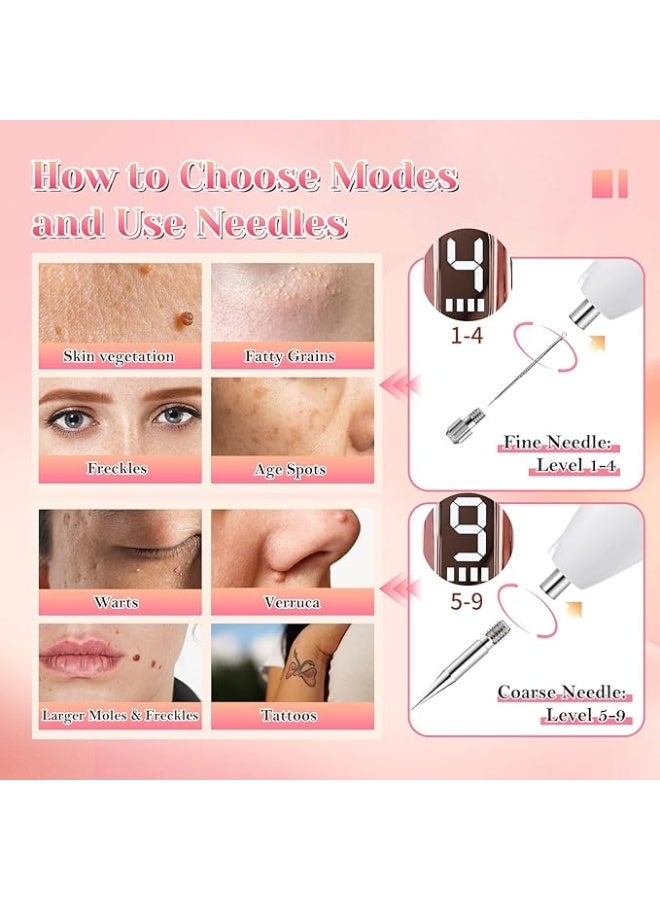 Intelligent 9-speed plasma skin cleansing device - high rigidity and wear-resistant, with built-in light-based spot removal pen, portable medical beauty tool suitable for all skin types (universal use/1 pack) - Image 4